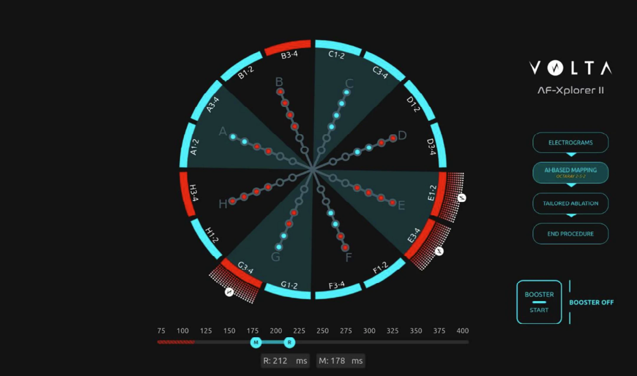 AF-Xplorer II-thumbnail